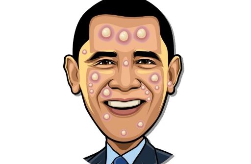 Celebrity Pimple Pop Play Browser Games